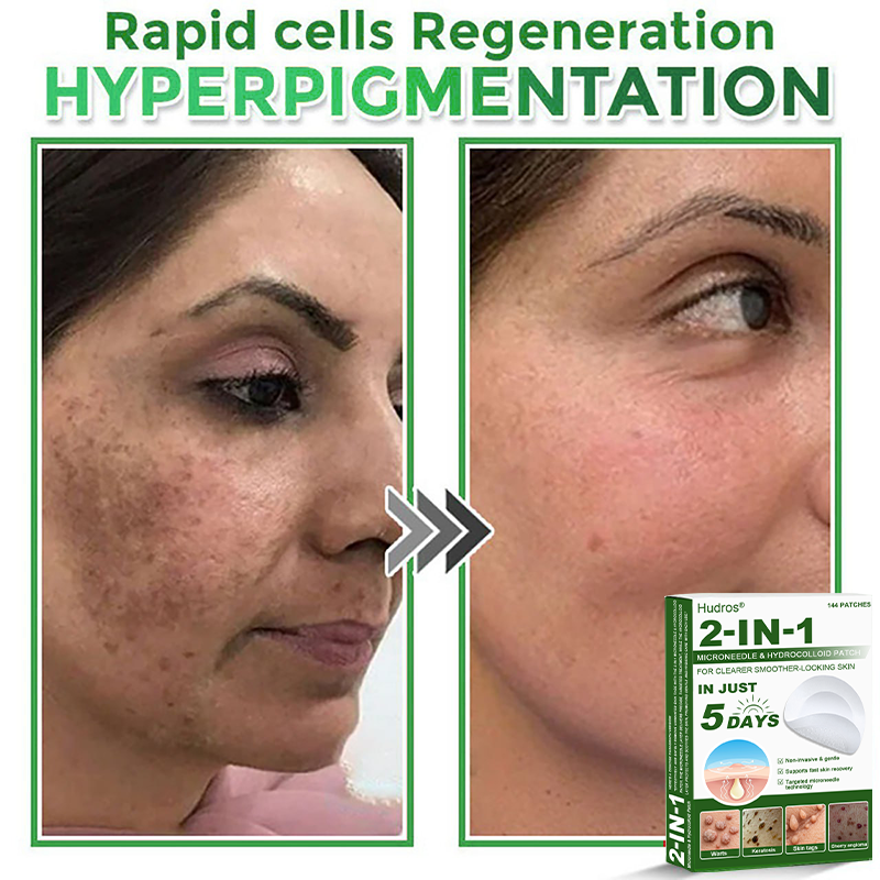 ⏳ Limited 5-Min Flash Sale! Add a second Hudros® 2-in-1 Patch and enjoy an extra 30% OFF.