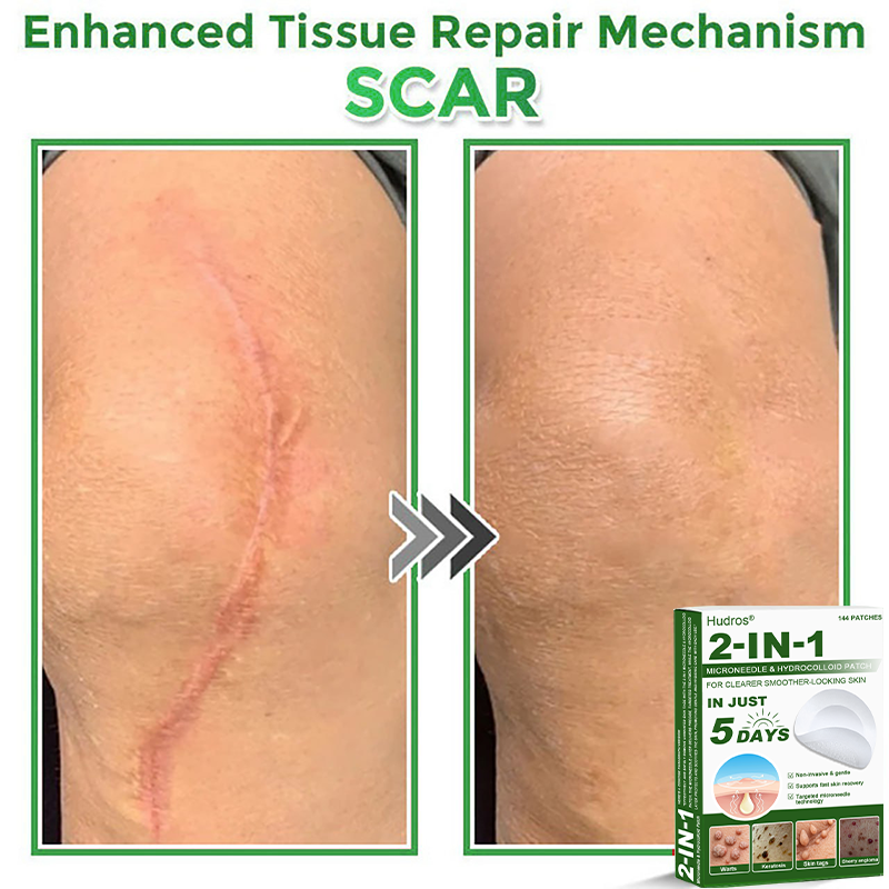 ⏳ Limited 5-Min Flash Sale! Add a second Hudros® 2-in-1 Patch and enjoy an extra 30% OFF.